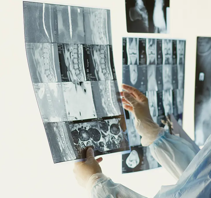 Catastrophic Injuries