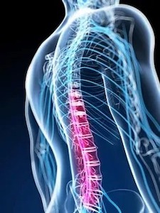 Lesión de la médula espinal